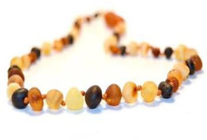 Baltic Amber Necklace for Adults